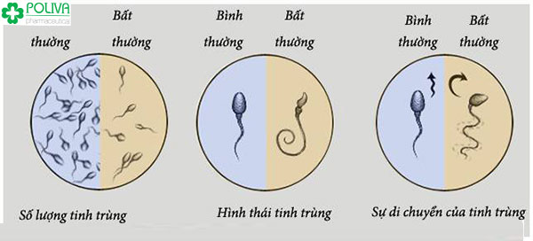 Dấu hiệu nhận biết tinh trùng yếu, tinh trùng ít, tinh trùng dị dạng