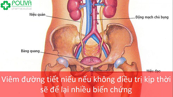 Bệnh viêm đường tiết niệu ở nam giới có gây vô sinh 