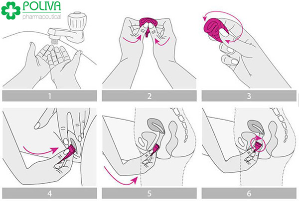 Hướng dẫn chi tiết cách sử dụng cốc nguyệt san.