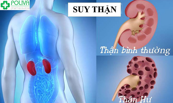 Suy thận dẫn tới suy giảm chức năng sinh lý nam giới