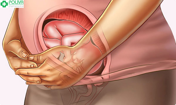 Do thai nhi quay đầu về phía tử cung và tụt sâu xuống vùng khung xương chậu nên bụng bầu của mẹ sa xuống thấp.