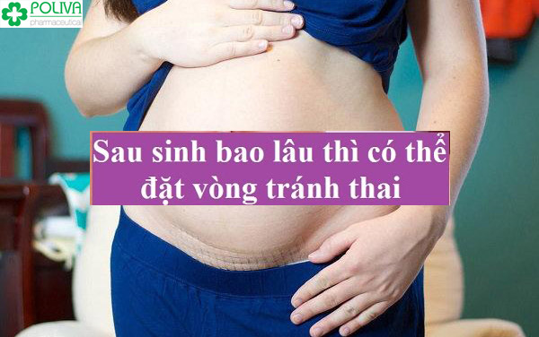 Đặt vòng tránh thai sau sinh là điều nên làm