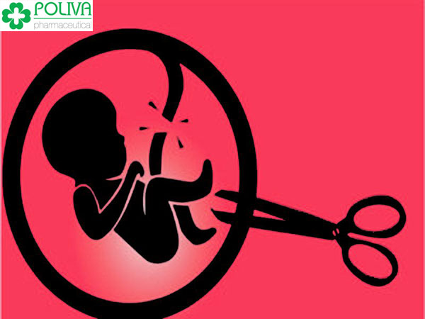 Nạo phá thai nhiều lần hay sẩy thai nhiều lần có tác động rất nhiều tới buồng trứng và tử cung