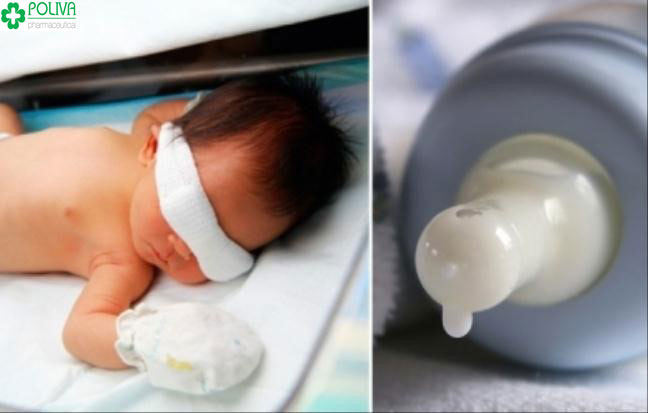 Nhỏ sữa mẹ vào mắt trẻ sơ sinh có thể gây hỏng mắt trẻ