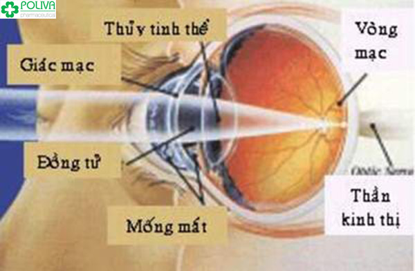 Tật khúc xạ là gì? Đọc ngay để biết các dạng và hậu quả của tật khúc xạ