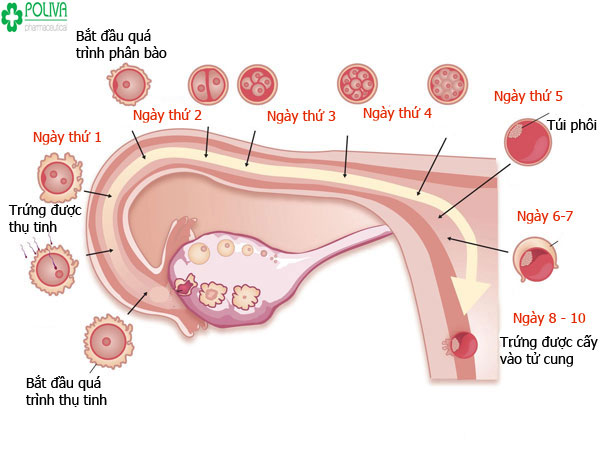 Mang thai ngoài tử cung là hiện tượng thai không nằm ở trong tử cung, nằm ở vị trí khác nhau như vòi trứng