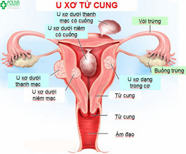 Tiềm mãn kinh có bị rong kinh không?