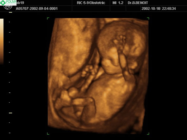 Hình ảnh siêu âm thai 16 tuần tuổi